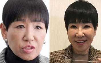 顔 和田アキ子 和田アキ子の目が変だったが改善した！病院を変更し眼瞼下垂の再手術を実施。
